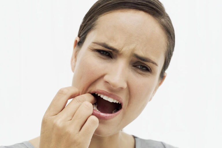 Oral Thrush