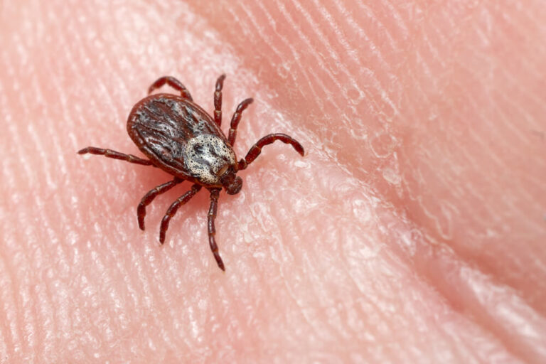 Tick Bites